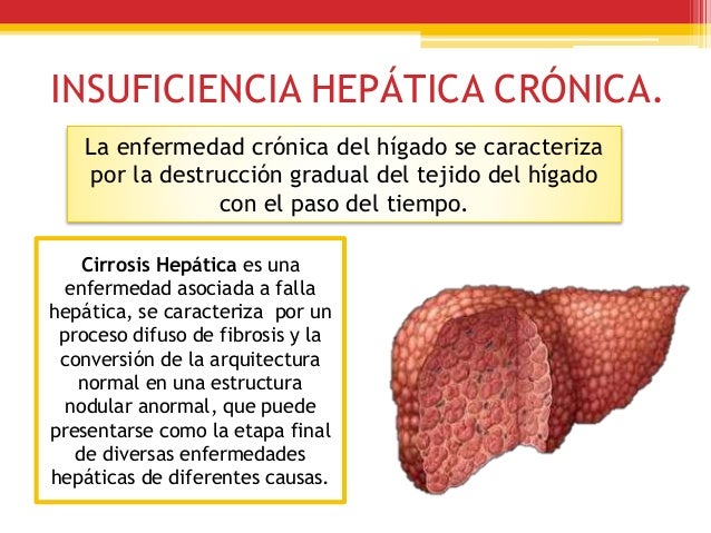 insuficiencia hepatica cronica